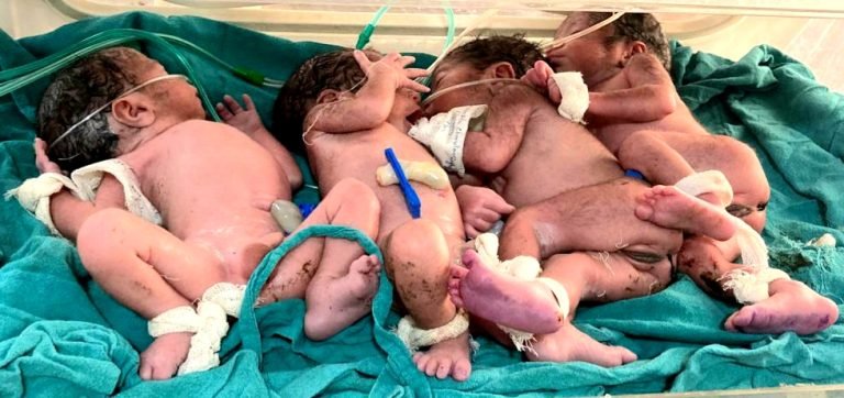 उम्मेद चिकित्सालय जोधपुर में एक साथ चार बच्चों का जन्म