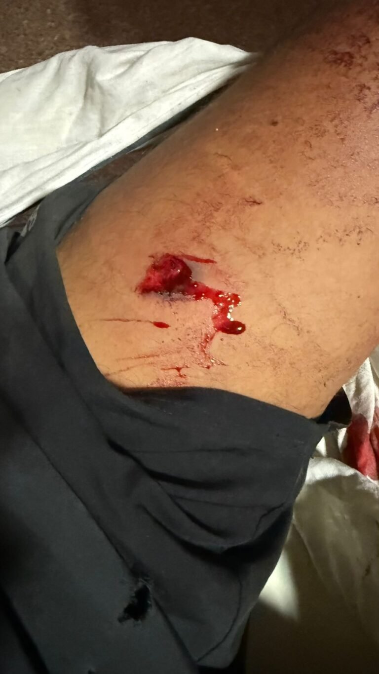 छह महिने पहले विवाद पर राजीनामा हुआ : प्रोपर्टी डीलर को कॉल कर बुलाया और फायरिंग की